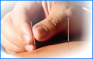 Raquel Aso Ricol persona practicándose una acupuntura